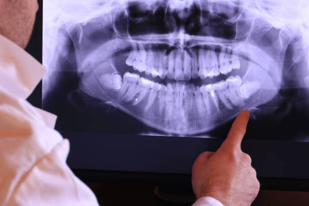 Best Emergency TMJ Treatment in Hennessey, OK