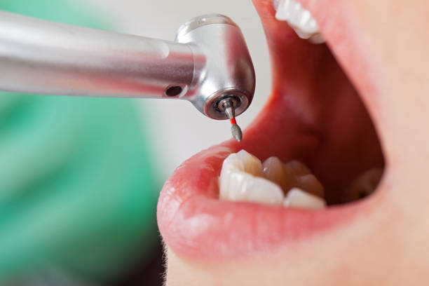 Best Urgent Care for Lost Fillings or Crowns in Hennessey, OK